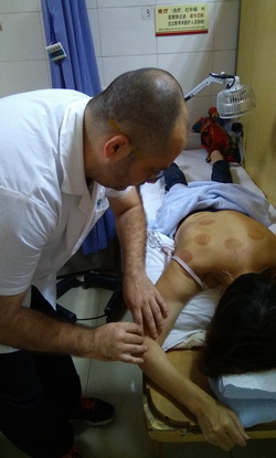 acupuncture_in_belgrade